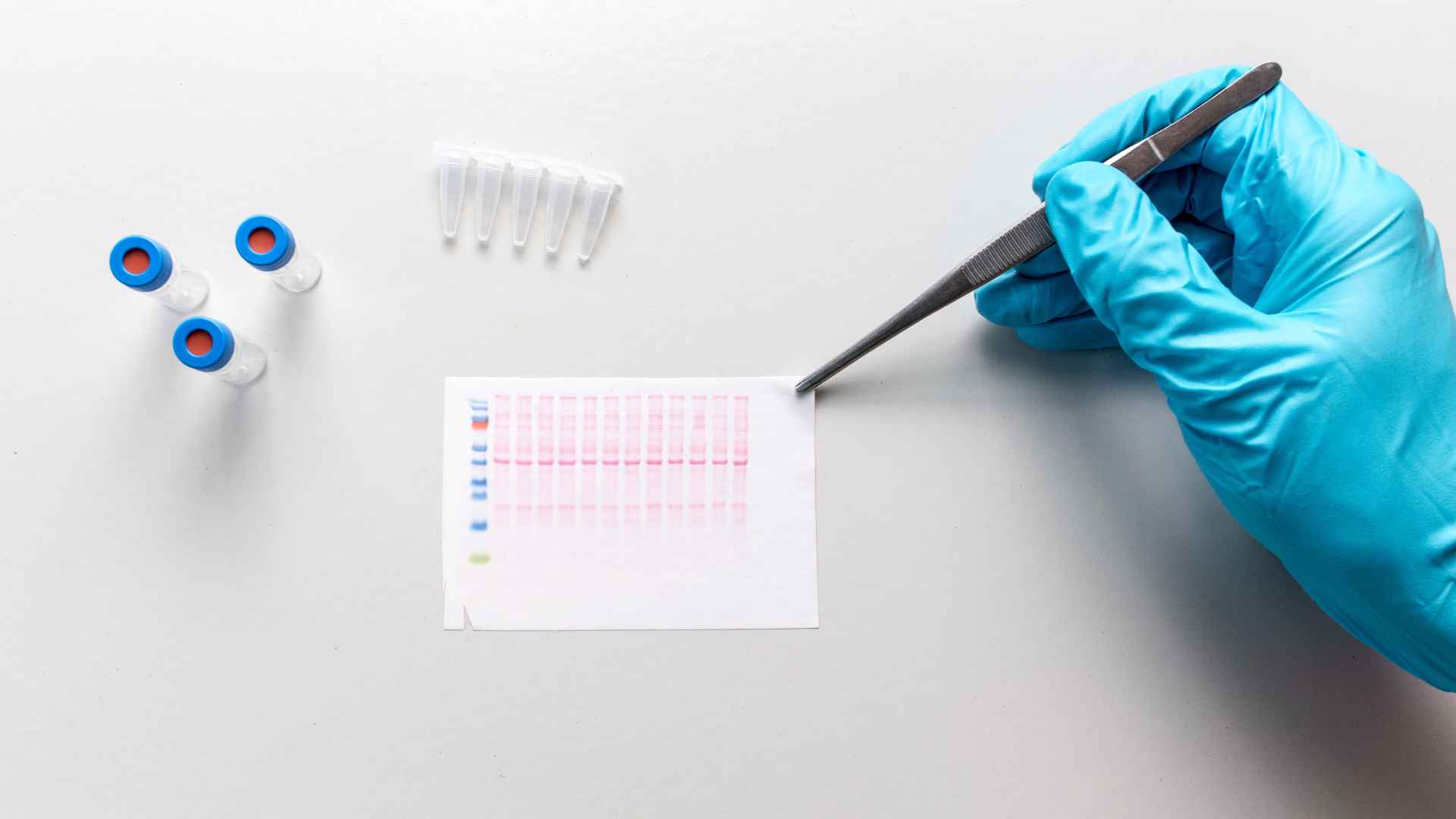 western blot assay